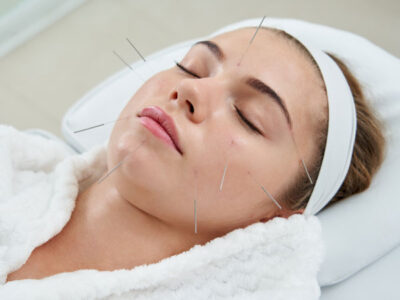 Dermatolojik Sorunlara Akupunktur Çözümleri