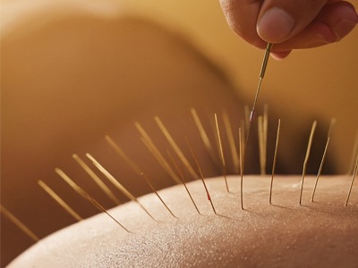 Akupunktur’da Kanatmalar